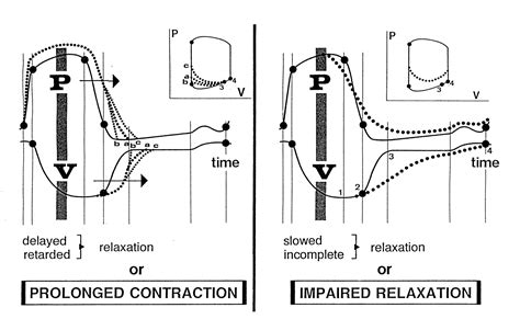 lv compliance meaning|impaired Lv relaxation treatment.